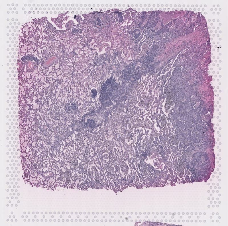 H&E-stained lung tissue, with predicted spatial gene expression over its right half