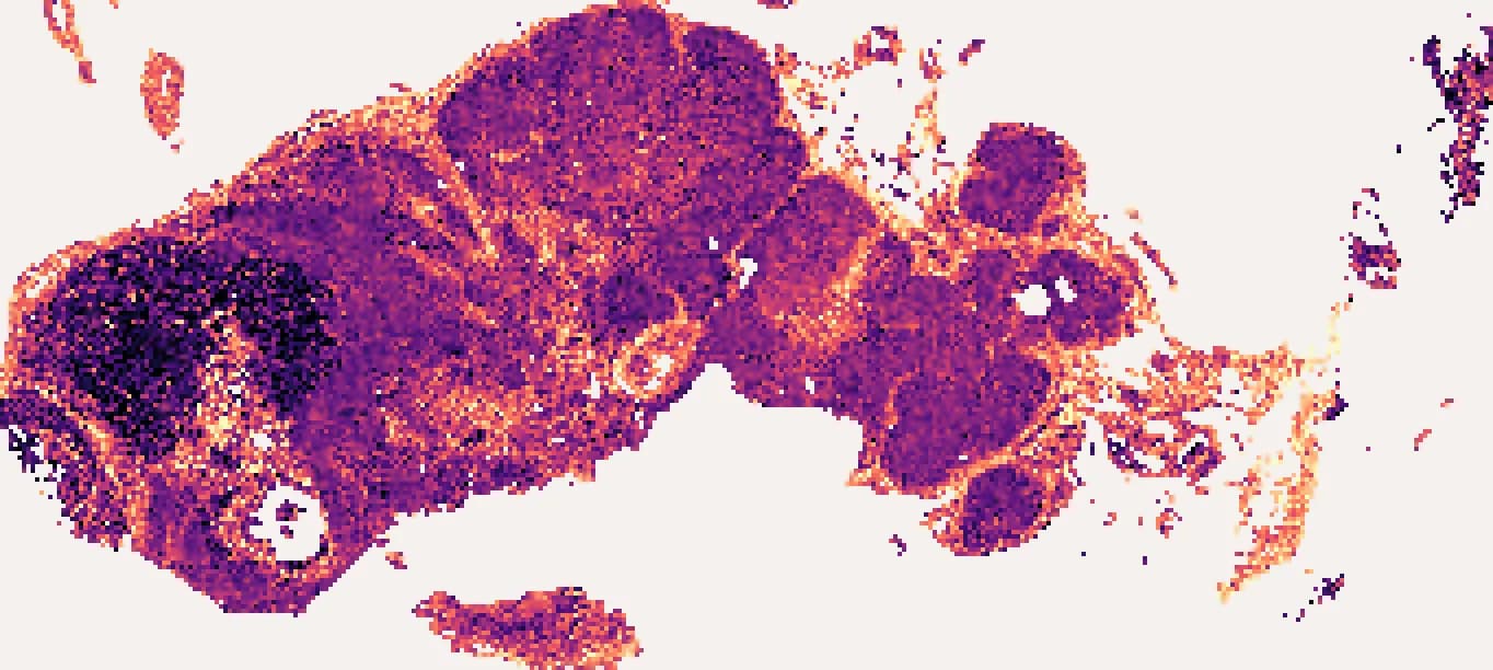 COL1A1 predicted across the whole section with this sample's own bulk profile: a heat map on the tissue, brightest along the capsule and the septa.