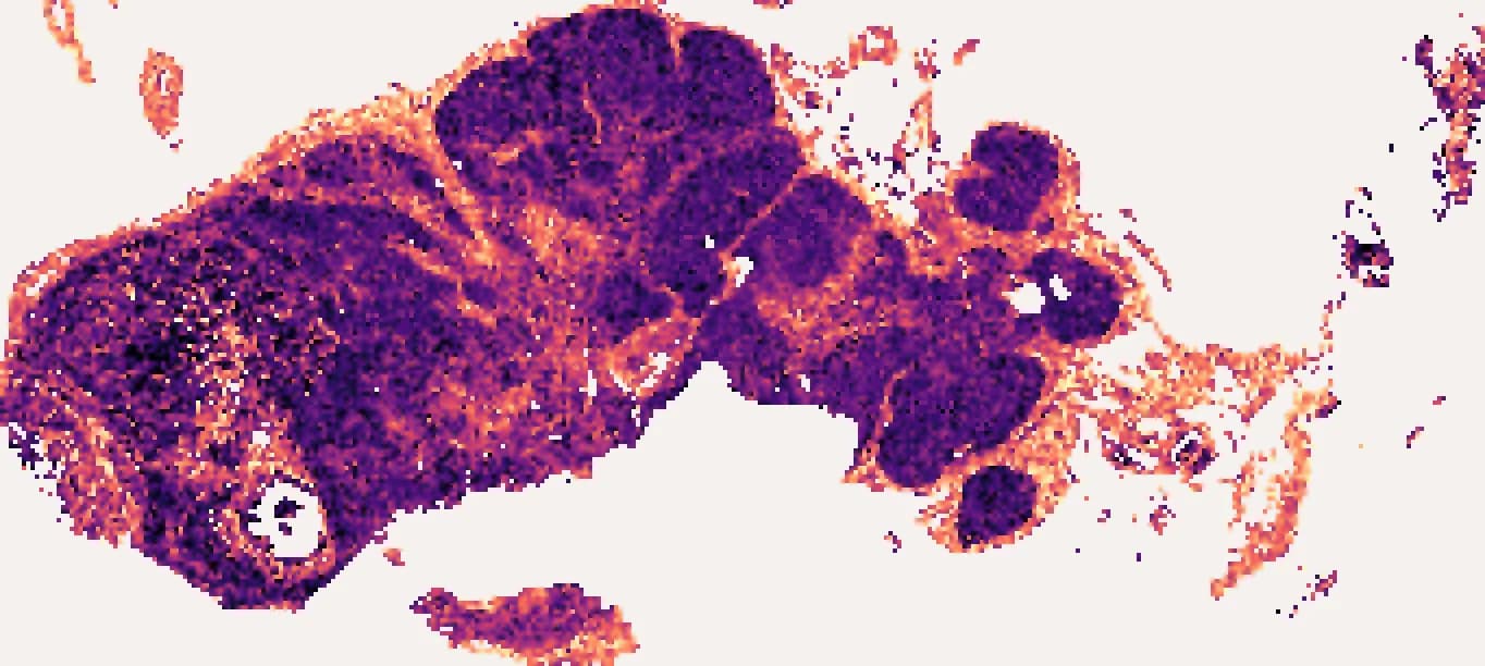 COL1A1 predicted across the whole section without a bulk profile: a heat map on the tissue, brightest along the capsule and the septa.