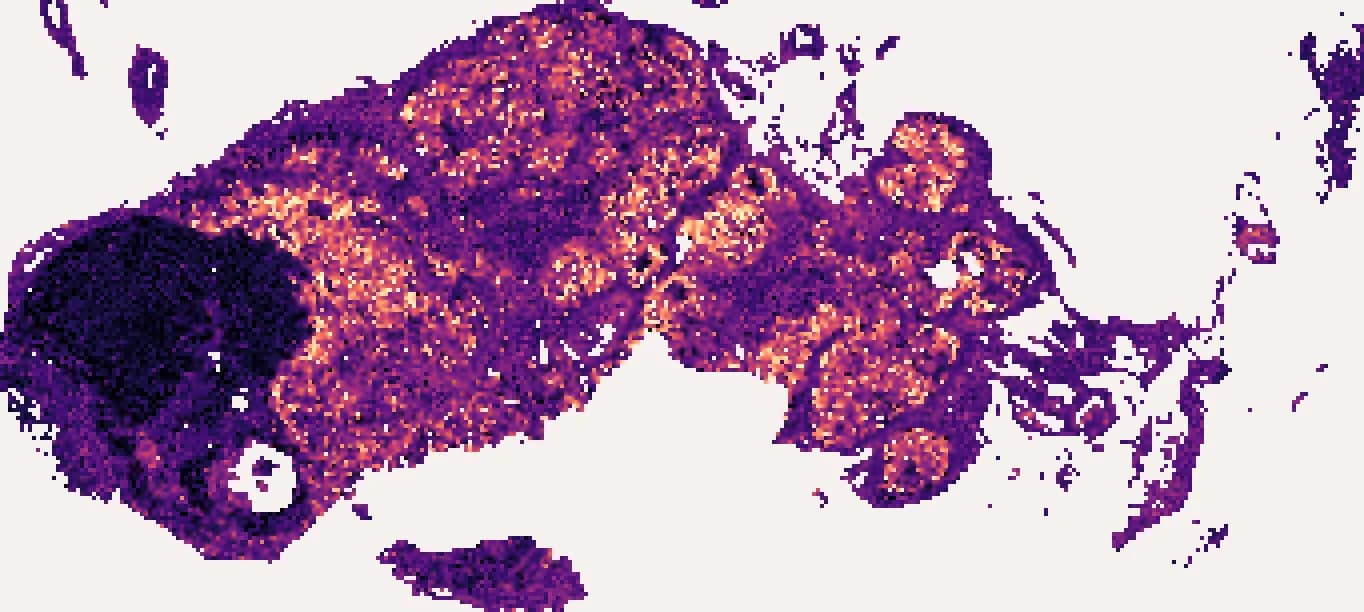 MS4A1 predicted across the whole section with this sample's own bulk profile: a heat map on the shape of the tissue, brightest in the B-cell follicles.