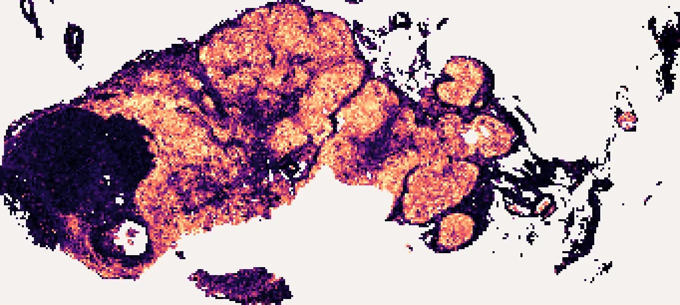 MS4A1 predicted across the whole section without a bulk profile: a heat map on the tissue, brightest in the round B-cell follicles.